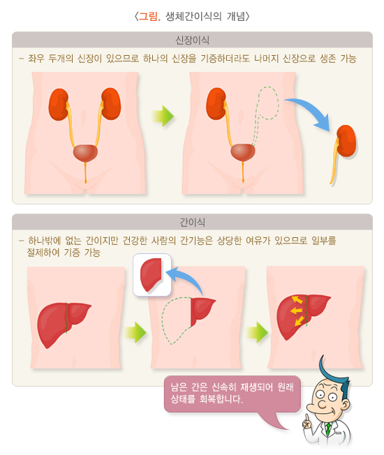 간암 환자 이식수술 후 입원요양병원