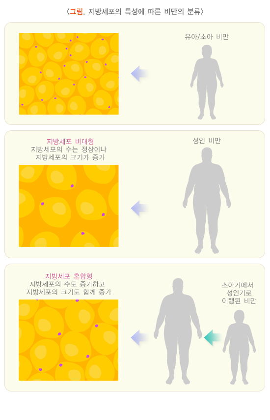지방세포의 특성에 따른 비만의 분류