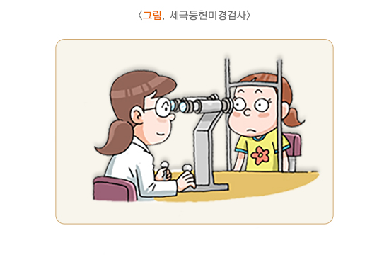 세극등현미경검사