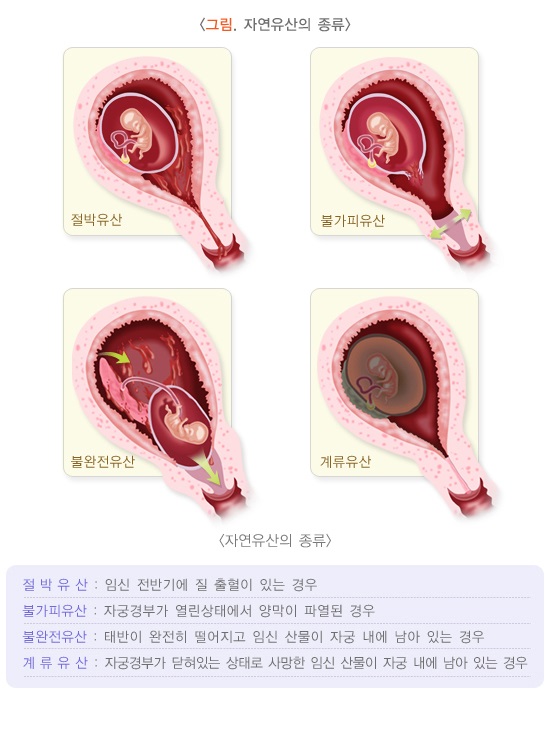 질병관리청 국가건강정보포털-자연유산