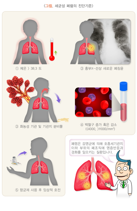 세균성 폐렴의 진단기준