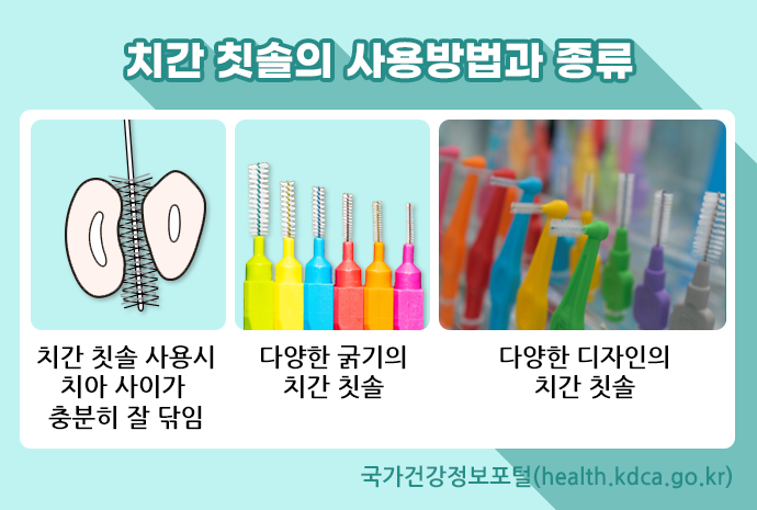 치간 칫솔의 사용방법과 종류. 치간 칫솔 사용시 치아 사이가 충분히  잘 닦임. 다양한 굵기의 치간 칫솔. 다양한 디자인의 치간 칫솔